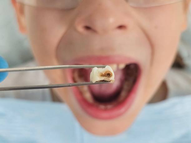 Best Emergency Treatment for Oral Infections in Chenoweth, OR